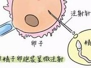 试管婴儿流程及费用详解